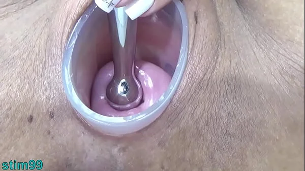 Japanese Wife Open Cervix Wide to watch inside Uterus